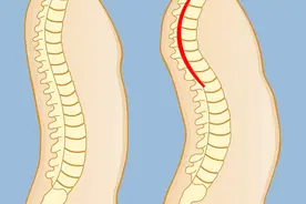 4个有效改善头前倾的居家训练图片