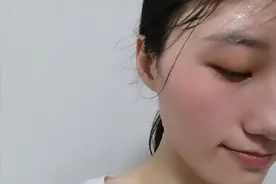 头上爱出汗的注意了，也许是这三个原因，看看你是哪一种？图片