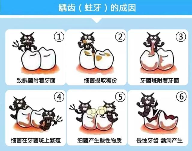 (小孩有蛀牙怎么办,牙齿上有个窟窿) - 冷求网
