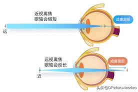 雾视屏、雾视镜都是个啥，如何用来治疗近视，看这一篇就够了图片