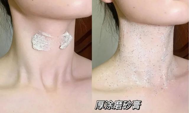 身上黑还有鸡皮疙瘩