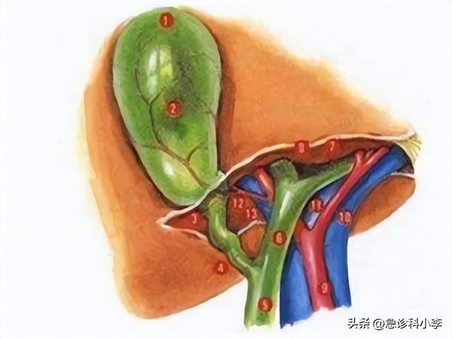 急性胆囊炎有哪些明显症状？如何避免急性胆囊炎？