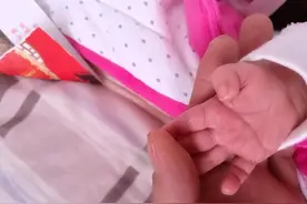 小宝宝手掌有“横纹”，代表智力有问题？来看看关于掌纹的秘密图片