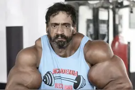 为追求更巨大的肌肉，他疯狂往身上注射“油”，最终害死了自己图片