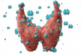 一图教你看懂甲状腺结节分级图片