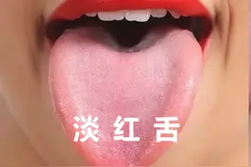 舌体颜色不同代表体质不同 你是哪种颜色？图片
