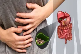 切除胆囊后，可能引发4个后遗症，提醒：不到万不得已尽量别切除图片