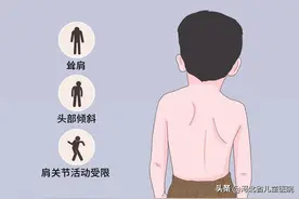 孩子的肩膀怎么一边高一边低啊图片
