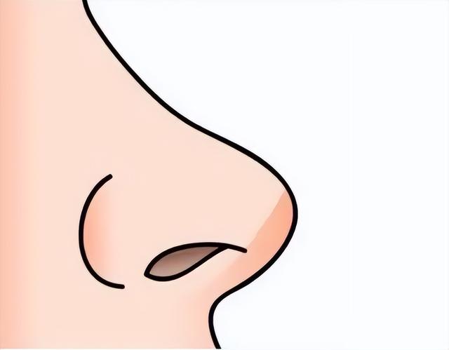 九院韦敏 | 鼻综合整形包含哪些项目?