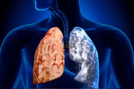 科学戒烟七步走，想不戒掉都难图片