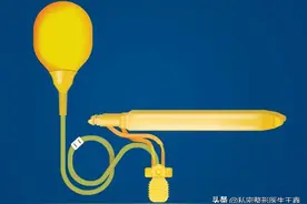 阴茎假体植入手术，可以改善早泄问题吗？图片