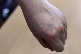 年过40岁，如果身体陆续出现5种情况，你不服老都不行图片