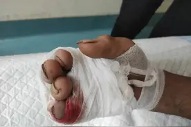 好危险！广西男子家门口遭银环蛇袭击！银环蛇为什么叫“吃席蛇”图片