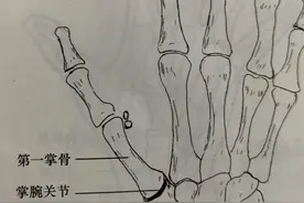 “大拇哥”痛、痛、痛图片