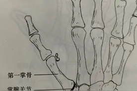“大拇哥”痛、痛、痛图片
