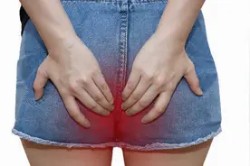 上完厕所屁眼灼热是怎么回事？图片