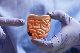 您有“洗屁股”的习惯吗？医生：经常清洗肛门，或能预防4种疾病图片