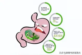 检测幽门螺杆菌，不知道注意事项？怎么更准确？肠胃教授一文详解图片