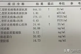 乙肝治疗，切莫见好就收图片
