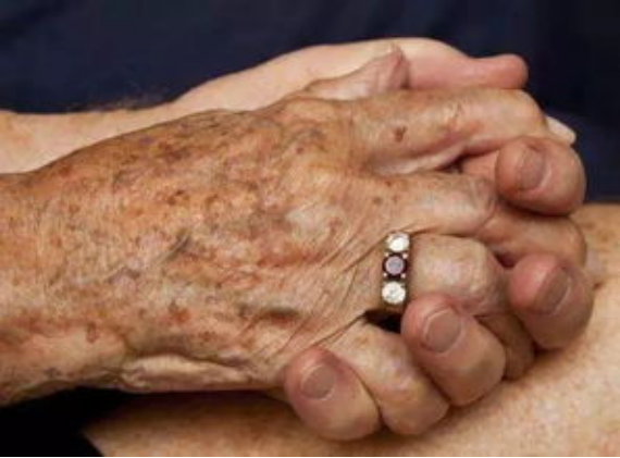 脸上角化栓很厚