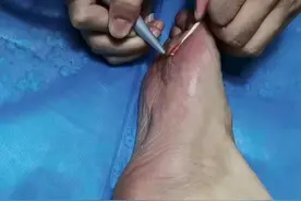 我忍住不哭，可还是一大把眼泪往下流，疼呵图片