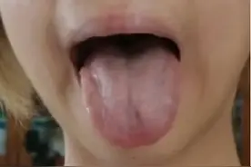 脾虚有湿，肝血不足，怎么正确调理呢？先温补肾阳，再疏肝理气图片