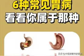 6种常见胃病，看看你属于哪种？图片