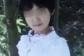 真实故事:武汉8岁女孩皮肤烫伤,与猪合体才能获救,父母悲痛不已图片