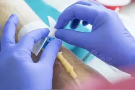 化疗到底对人身体伤害有多大？该不该化疗？图片