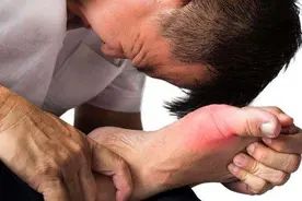 急性痛风性关节炎发作就医前要做什么准备？挂什么科？图片