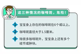 宝宝手上长胎记，一查竟是血管瘤！医生：这5种胎记要早处理图片