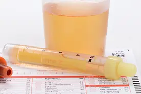 排出的尿很黄、异味很大？医生提醒：可能是身体在向你预警图片