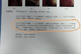 刘懿博士说肺癌（三九一七）肺癌气管镜取到病理了么？看镜下报告图片