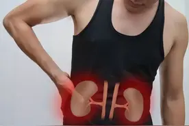 肾结石疼痛的时候是什么样的症状？图片