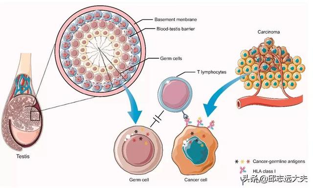 研究肿瘤必须知道的十一类肿瘤抗原