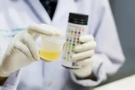 日常生活中如何辨别“泡沫尿”以尽早发现危险因素呢？图片