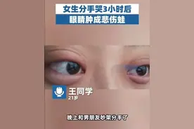 女生分手哭3小时眼睛肿成悲伤蛙，画面超级搞笑！图片