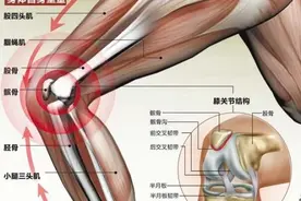 膝关节置换10年后有感图片