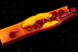 体内有痰浊，血管难干净！一杯茶心脑同调，活血化瘀，血管通畅图片