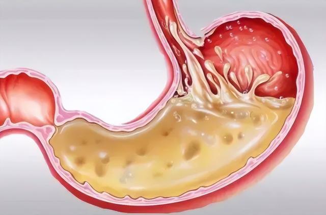 人死后,散发的尸臭有多恐怖?如何形成,一旦沾上怎么祛除