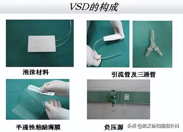 足底过度角化名词解释