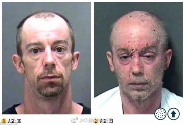 这才是吸毒前后真实的面容变化