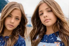 “世界上最漂亮的双胞胎”现在长成“大”姑娘了图片