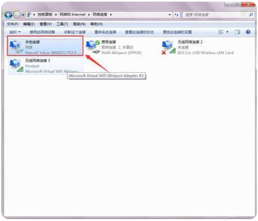 电脑系统里如何设置dns服务器