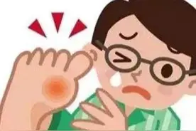 痛风发作，疼的原地打滚。三甲医院药师指导用药，一定要收藏图片