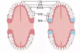 智齿！别疼了~图片