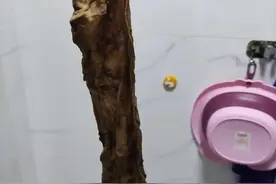 南昌一女子产后体内遗留纱布，解决纠纷不是最终目的图片