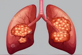 手术成功了，为什么人不久后还是离世了？医生说出原因图片