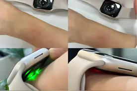 数百人因戴苹果手表手腕处发生红肿现象图片