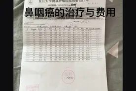 说说我老公鼻咽癌的治疗与费用图片